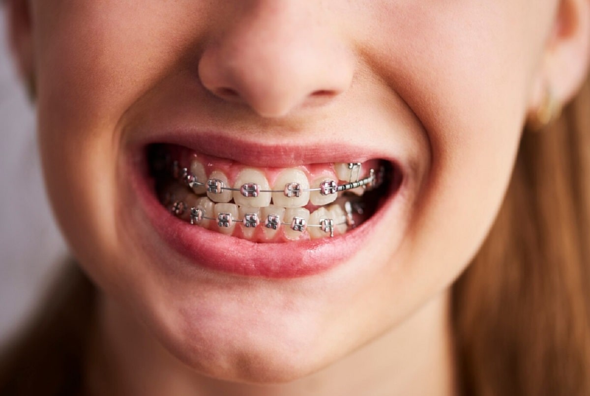 genc-ortodonti