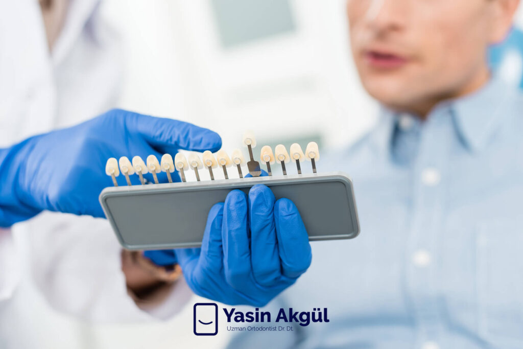 Diş İmplant Fiyatları 2022 - Ortodontist Dr. Dt. Yasin Akgül