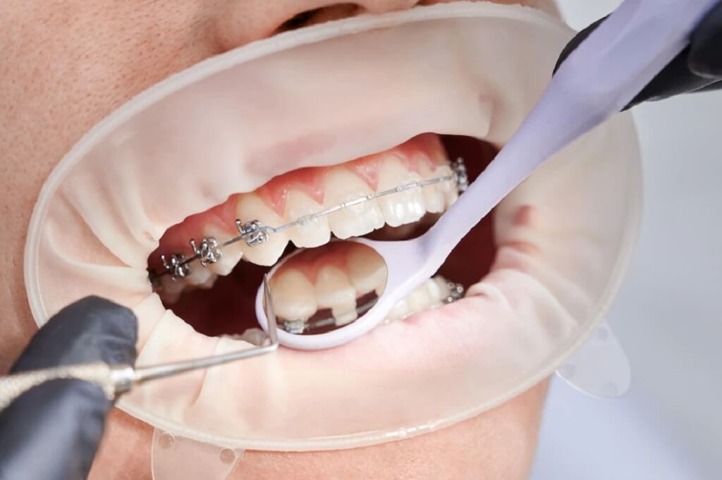 ortodonti-uzmani-2