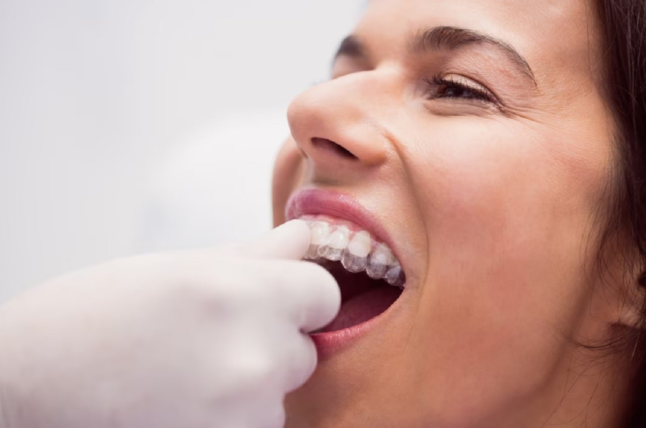 ortodontik-tedavi-nedir-ne-kadar-surer